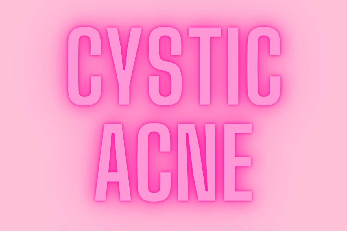 CLEARING ACNE CYSTS: WHAT YOU NEED TO KNOW