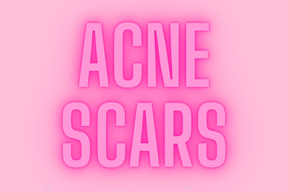 OUR QUICK, EASY GUIDE TO TREATING ACNE SCARS
