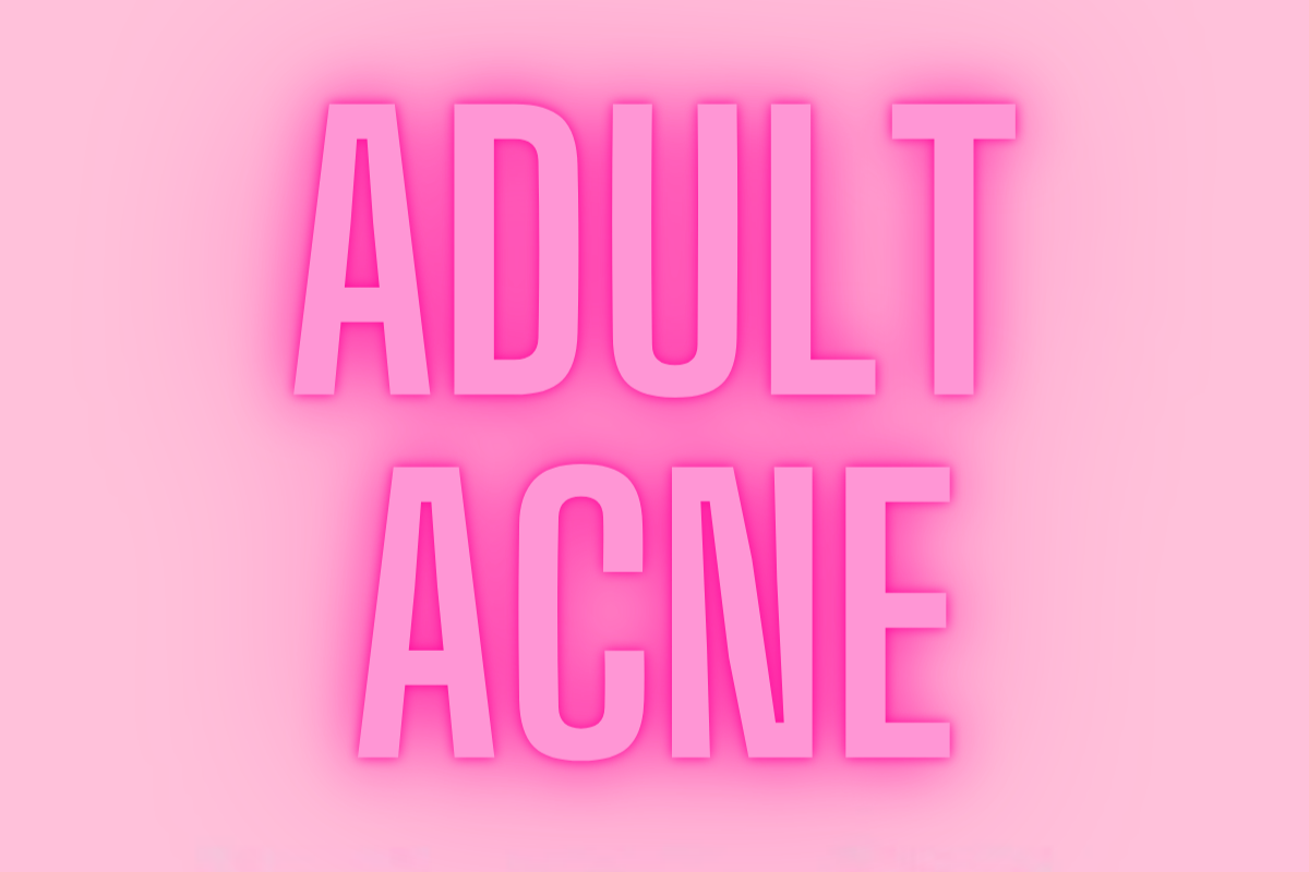 Adult Acne