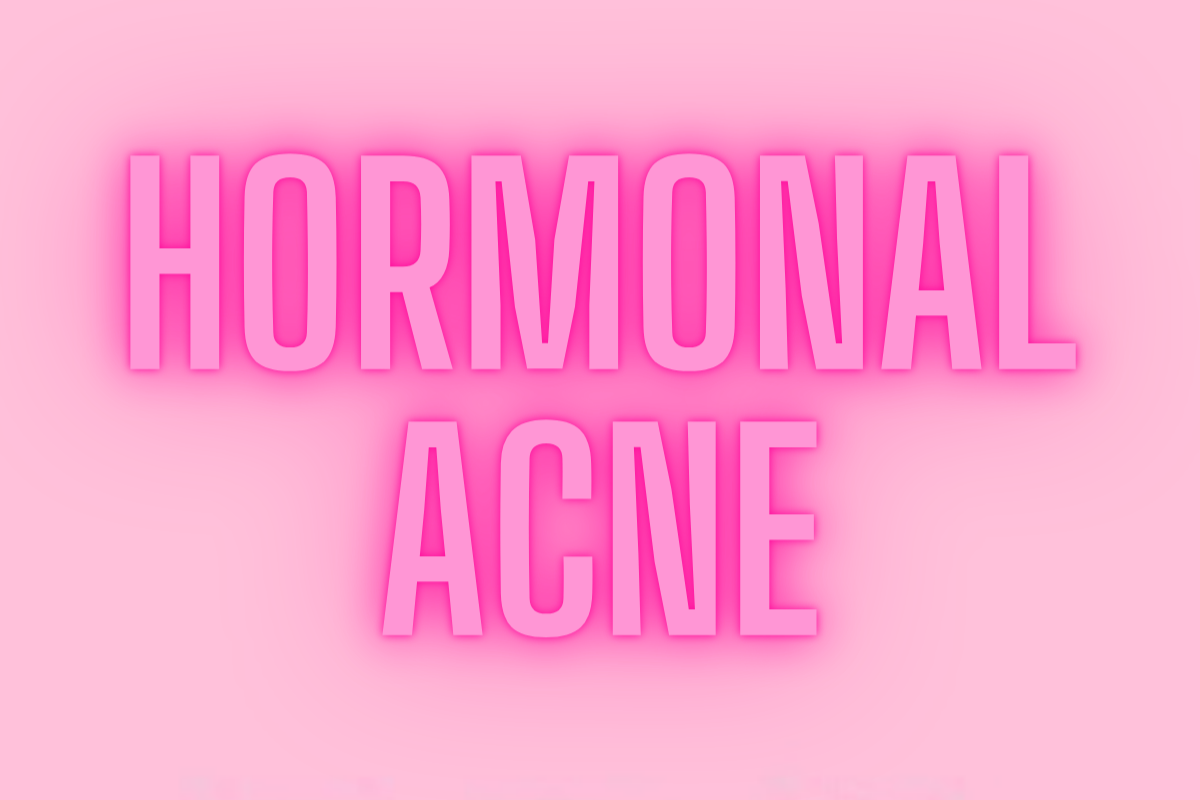 5 TIPS TO CLEAR HORMONAL ACNE