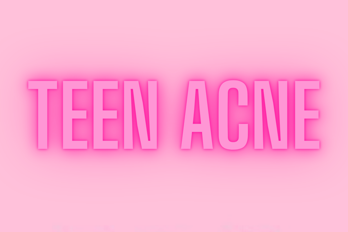 10 TIPS TO TACKLE TEEN ACNE 