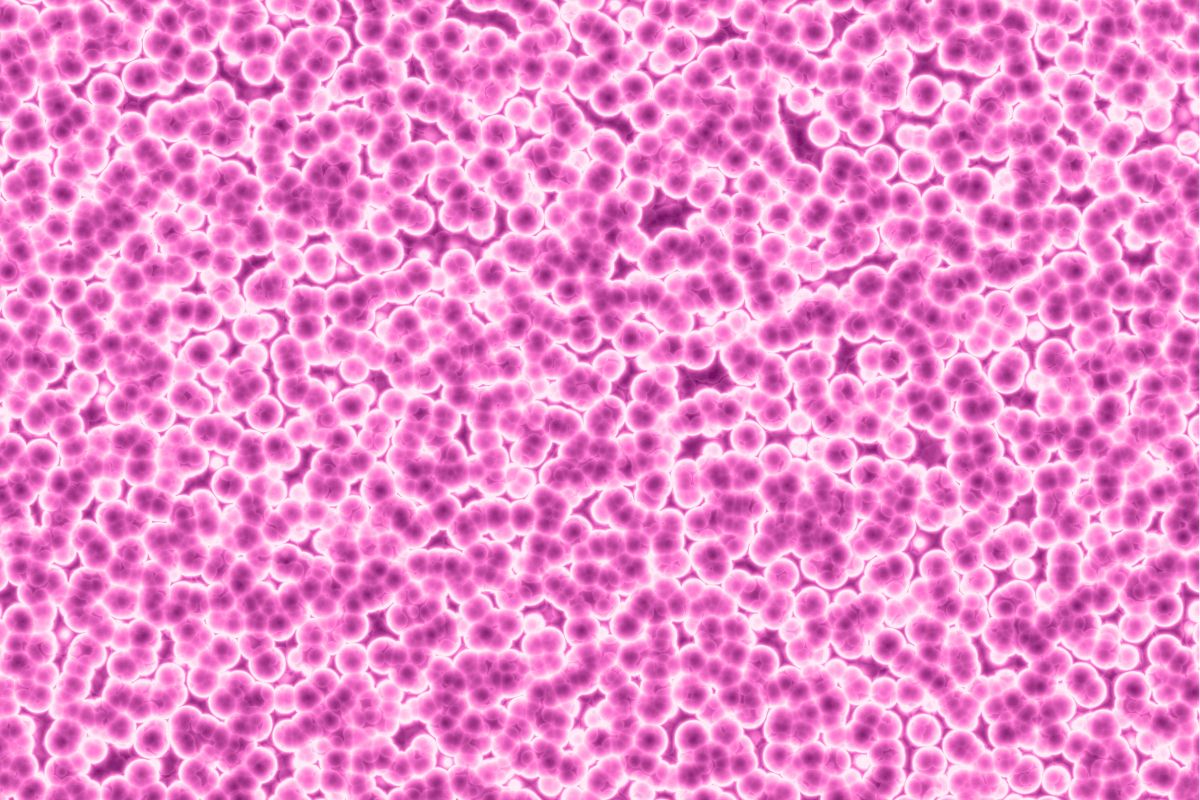 ACNE AND MICRO FLORA